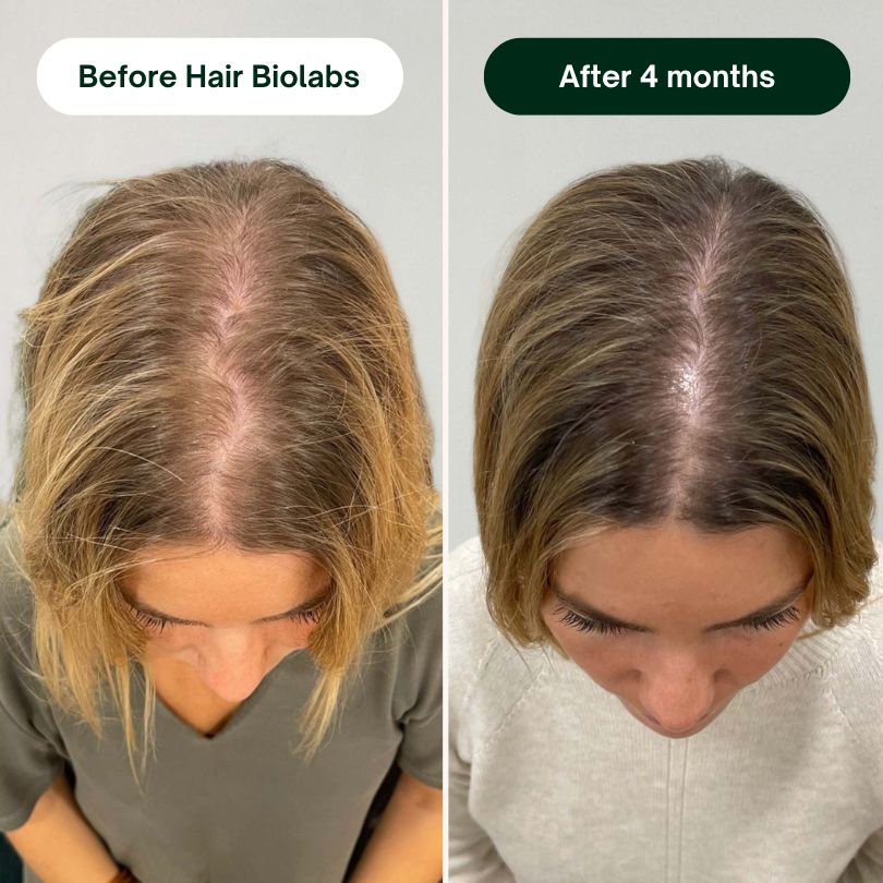 Hair Biolabs - Stops Hair Loss in 21 Days