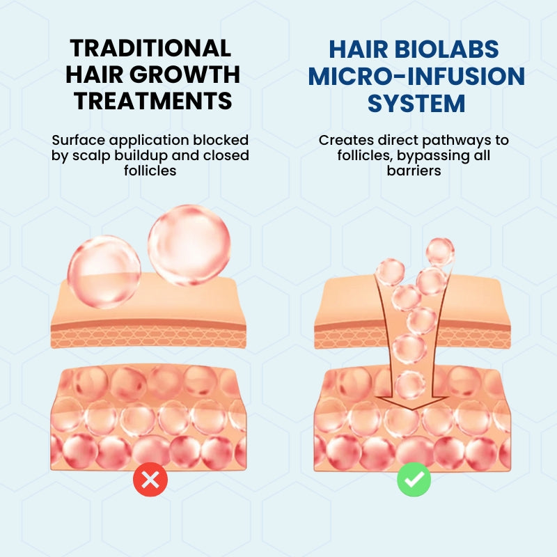 Clinical Regrowth Filler - Hair Biolabs™ Microneedling System