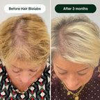 Hair Biolabs REDENSIFY™ Triple Action Protocol- Stops Hair Loss in 21 Days